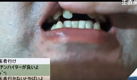 2017-06-09 14-59-52-652