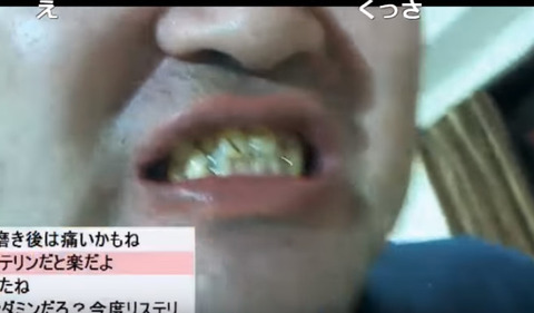 2017-06-09 14-54-03-422