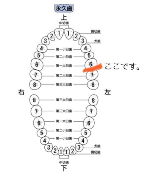 nb007