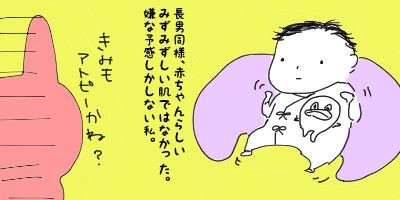 【みー】アトピー疑惑の次男