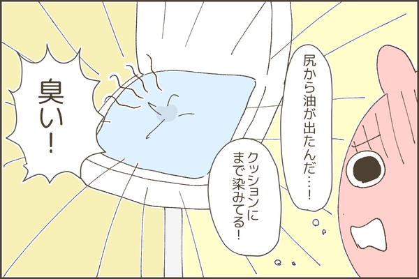 533