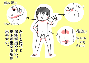 3か月ぶりの病院でした