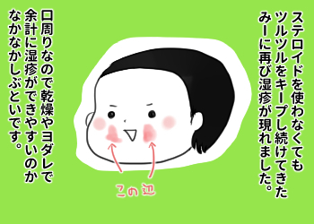 【アトピー】恐れていたことが…！