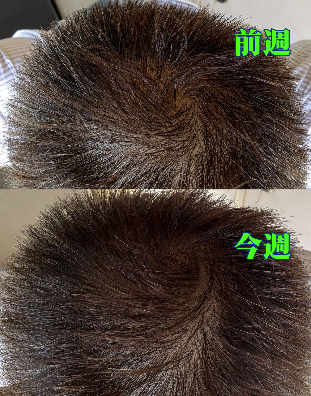 リモウレポート ９週目です いとしのナナへ