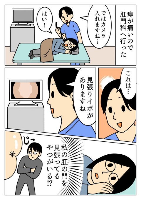 肛の門を見張るもの