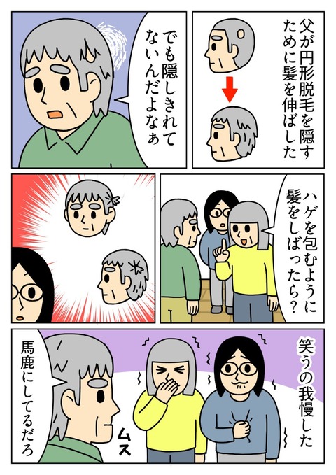 ハゲの周りの毛を縛って隠す