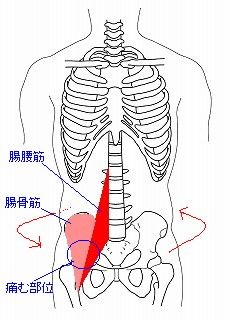 右 骨盤 近く の 痛み