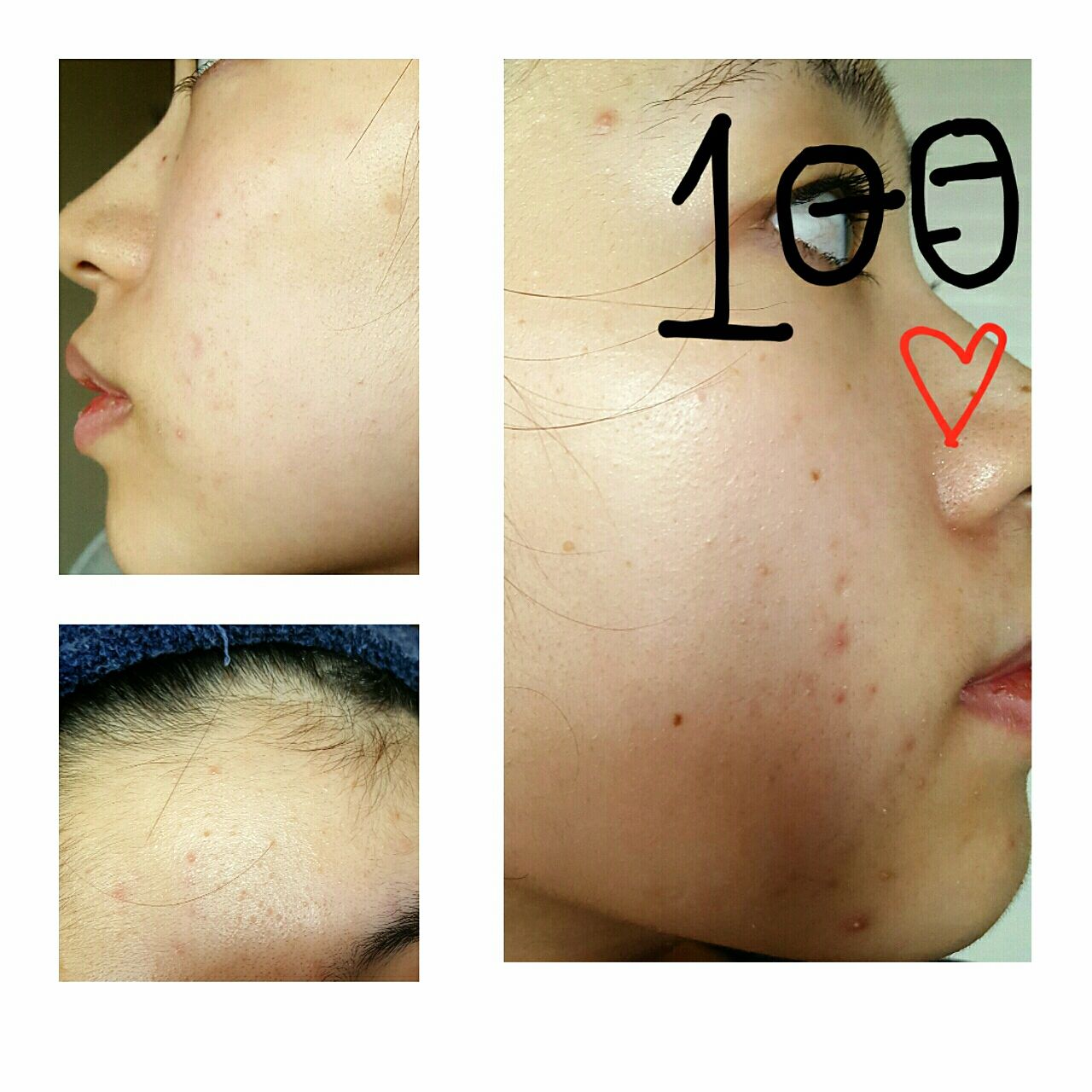 美容 顔を1週間洗わないと どうなるのか実践 １日目 なんでも 実践 ぶろぐ