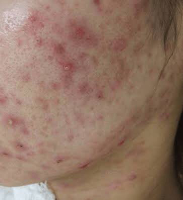 肌が汚いってだけで人生が積むという事実 なんjコレクション