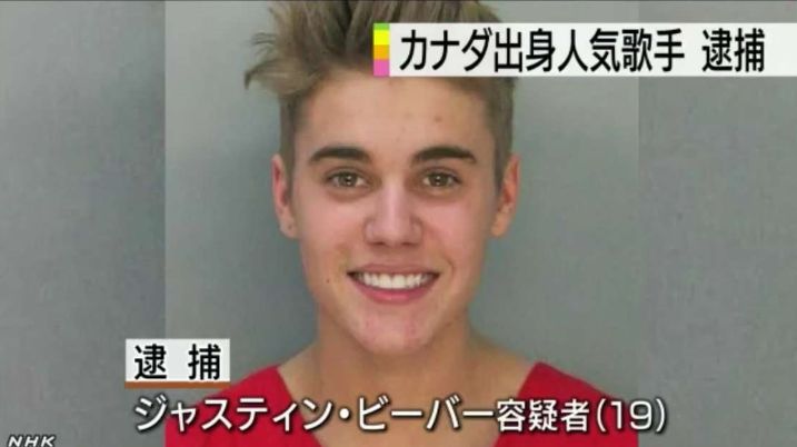 悲報 ジャスティンビーバーさん 別人のような顔になる なんjコレクション