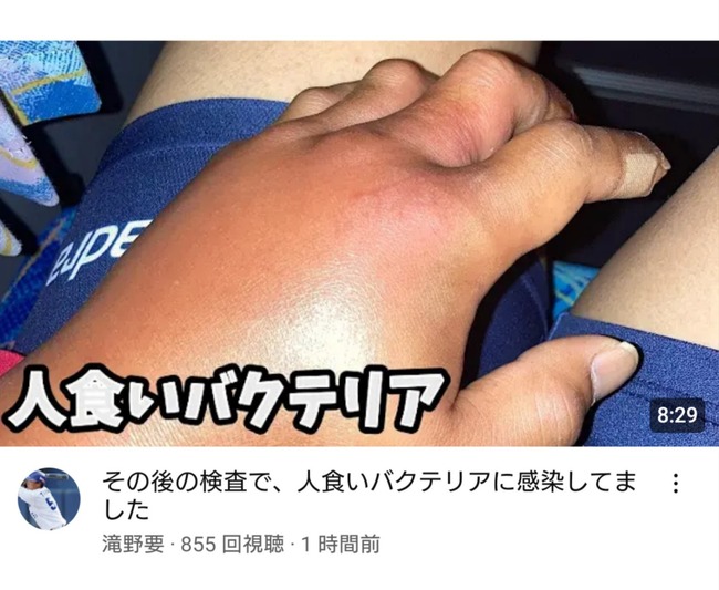 【悲報】元中日の滝野、人喰いバクテリアに感染