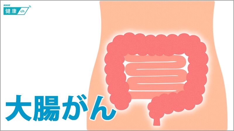 【医療】若者の間で大腸がんが「不安になるほどのスピード」で急増！
