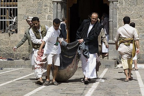 APTOPIX-Mideast-Yemen_Horo-1
