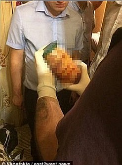 Russia, cannibali arrestati le cose da sapere - Lettera43