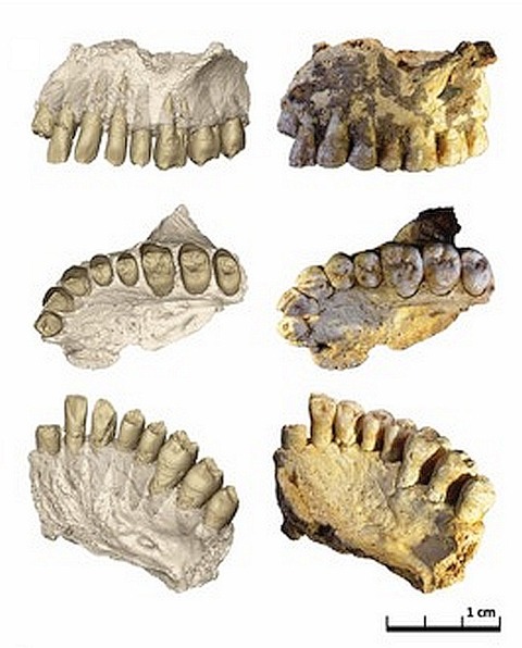 dentitions-1