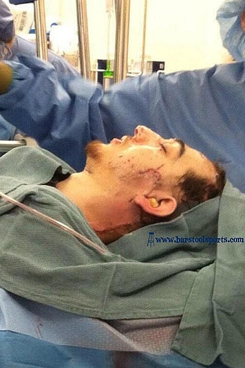 DZHOKHAR-TSARNAEV-BOSTON-BOMBER-WOUNDED-HOSPITAL-PIC