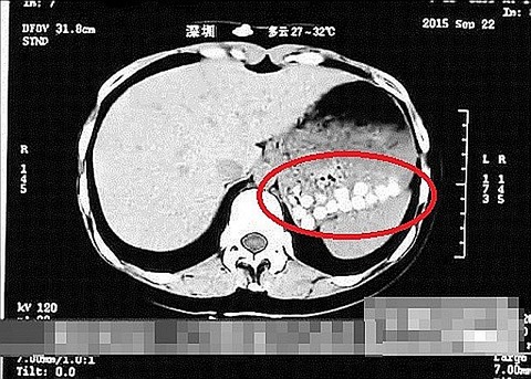 bkncn-20151019182735520-1019_05011_001_09p
