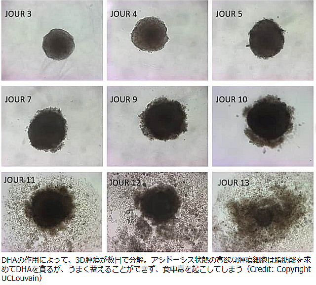 FireShot Webpage Screenshot #498 - 'がんの腫瘍を破壊