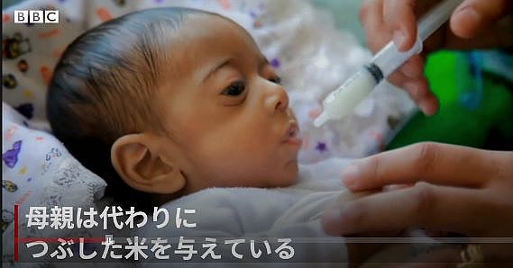 FireShot Webpage Screenshot #1383 - 'ガザの子供8000人超が急性