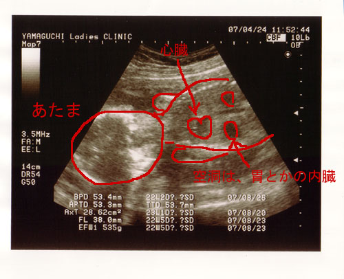 ２２週５日目 検診の日 妊娠 出産生活ブログ 出産したのよ