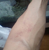 ���饲�ǡ�