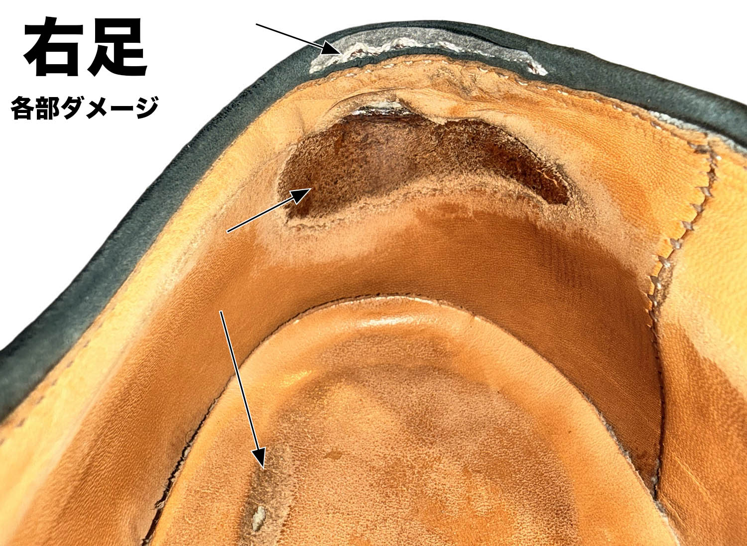 右足：同様のダメージ