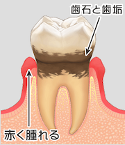 中村1