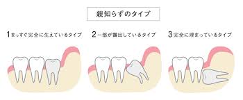 このき写真1