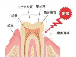 このき写真１