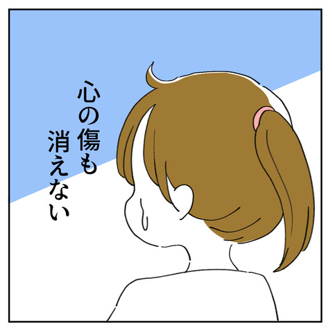 47_7