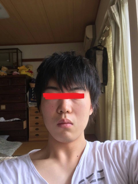 画像あり 歯列矯正一年たったら顔変わりすぎワロタｗｗｗｗｗｗｗｗｗｗｗ ネギ速