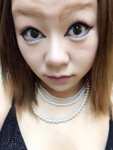 閲覧注意 美容整形依存症になった結果wwwwwwwwwww ネギ速 閲覧注意 美容整形依存症になった結果wwwwwwwwwww ネギ速