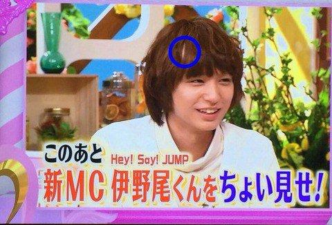 伊野尾慧 ハゲ