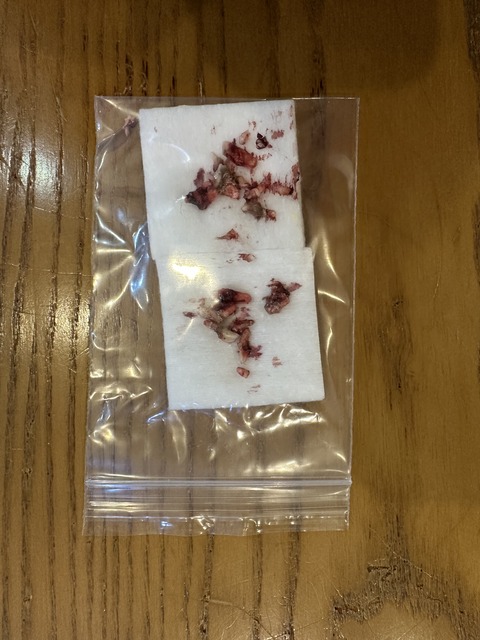 DC281661-7B2B-426D-BFB2-6AAB95F5C878