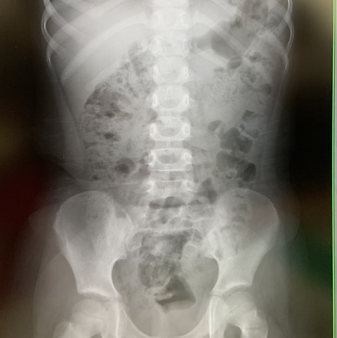 CE8662DE-468F-4CB7-A279-D85F7DD7C4AD