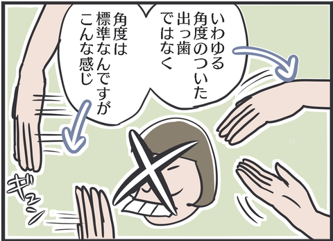 歯科矯正