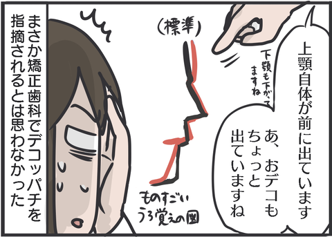 矯正の検査