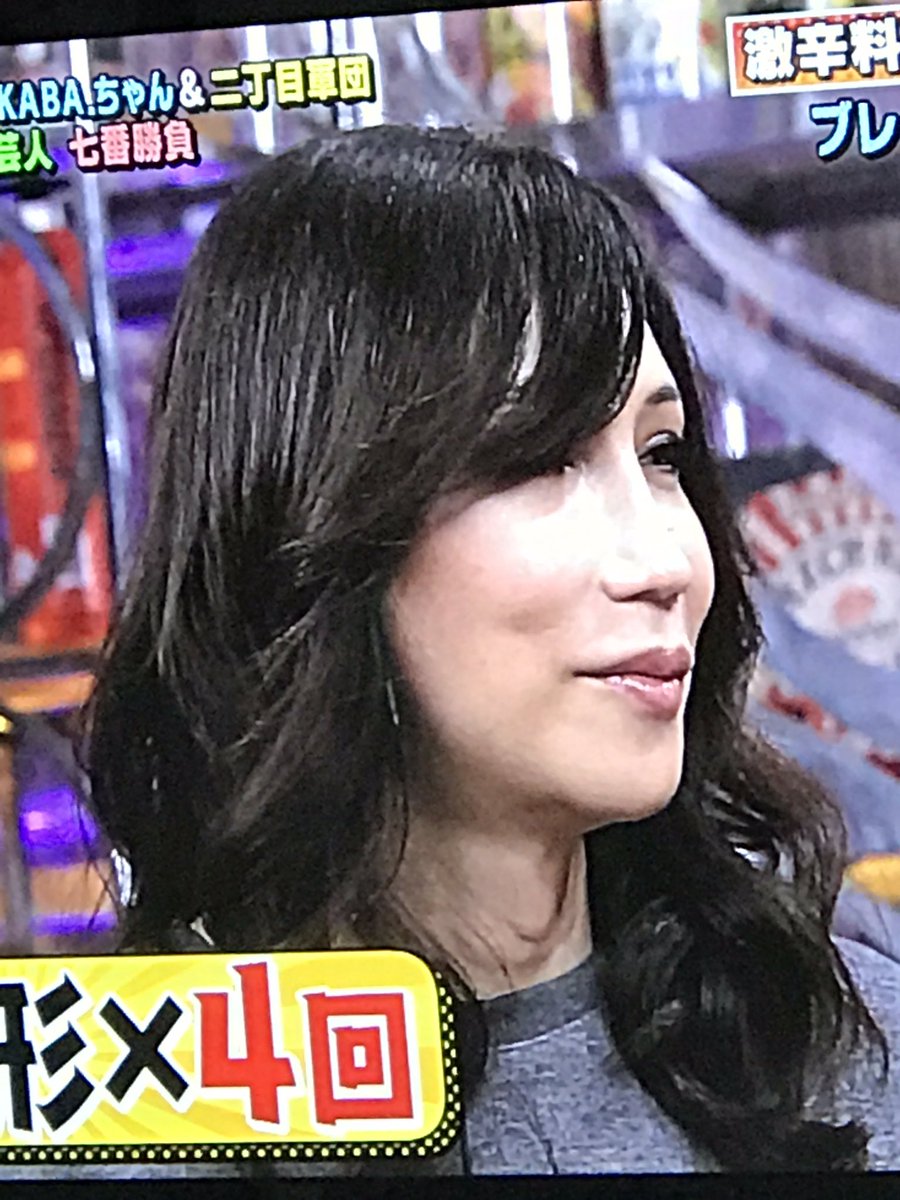 画像 kaba ちゃん 整形4回 今年中の完成を目指すwwwwwww 話のネタ帳 画像 kaba ちゃん 整形4回 今年中の完成を目指すwwwwwww 話のネタ帳