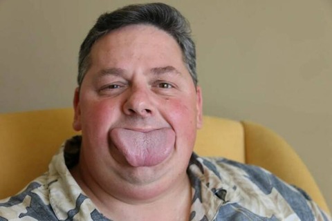 異常に「舌」が大きいビックリ人間