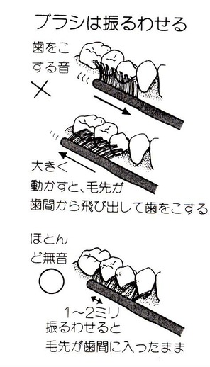 brushing1