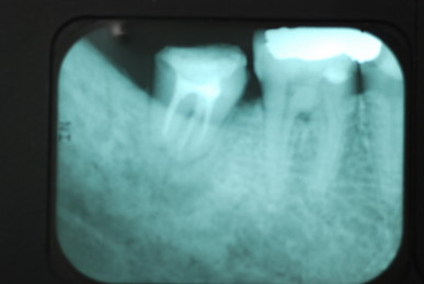 DSC_0014 - ���ԡ�