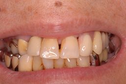 10151323_612824175460905_7506860736155202731_n[1]