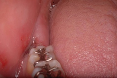 50224110_2063602677049707_8629261215232688128_n[1]