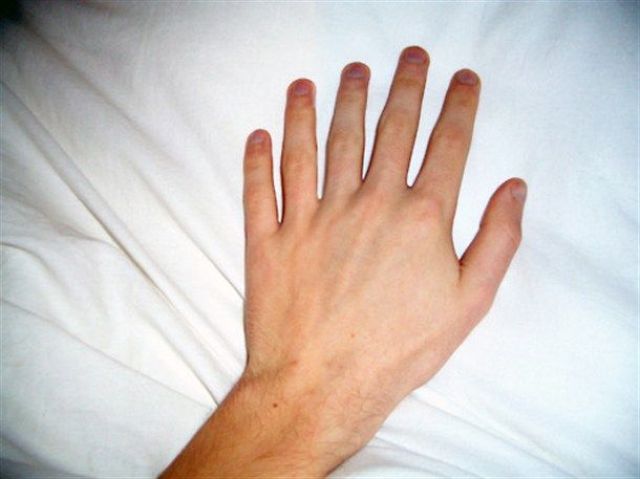 閲覧注意 多指症の奴wwwwwww だぼ速報 閲覧注意 多指症の奴wwwwwww だぼ速報