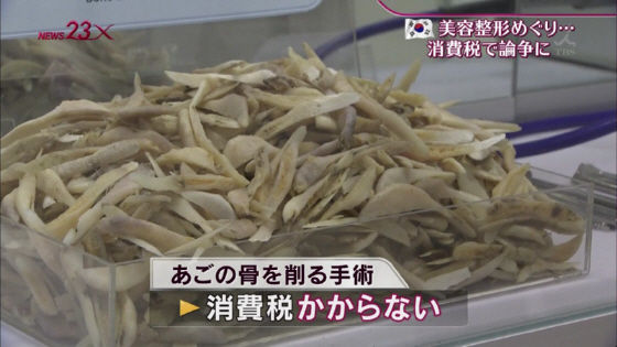 韓国人女子大生 両エラを切除後に死亡 Mabuchanのblog 韓国人女子大生 両エラを切除後に死亡 Mabuchanのblog