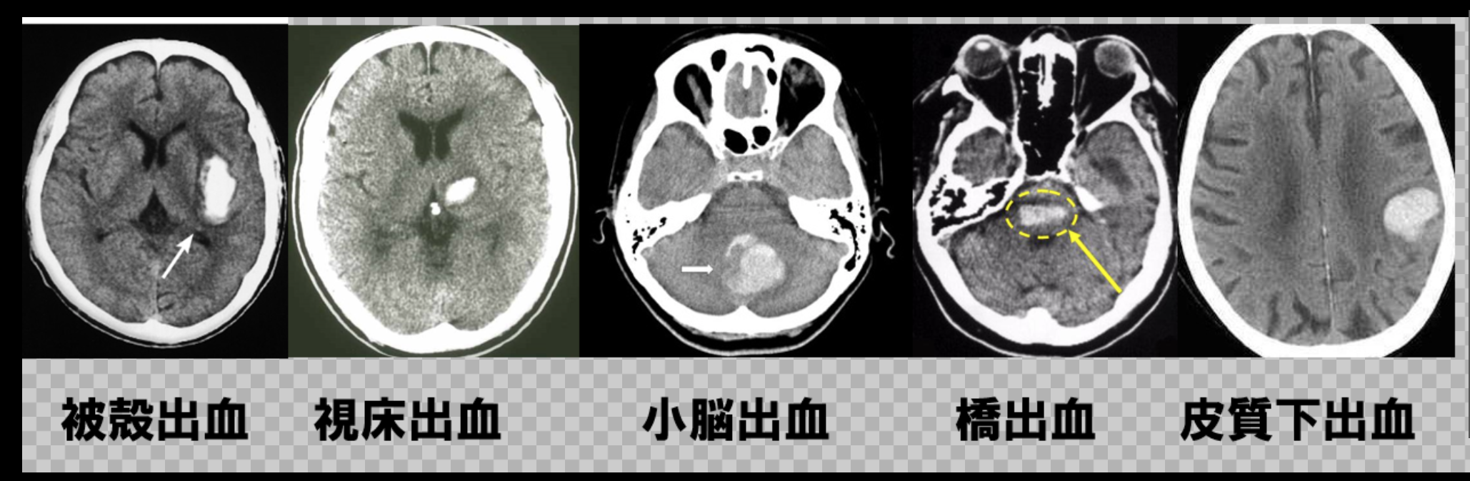 世界一わかりやすい医学〜人工知能時代における医学情報の再 ...