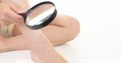 アメリカなどの研究グループ「ほくろの毛はなぜ生えるか研究すればハゲも治るかも」