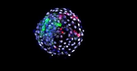 病気を再現した「キメラ」のサルが中国で誕生する、これ怖くない…？