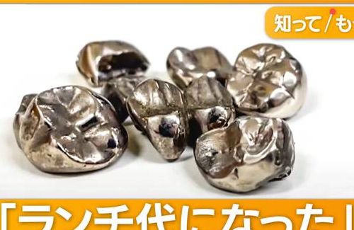 【！？】ブックオフ、『銀歯』の買取を一部店舗で開始ｗｗｗ