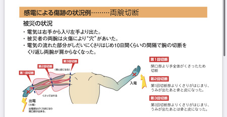 【驚愕】感電さん、思ったより怖い